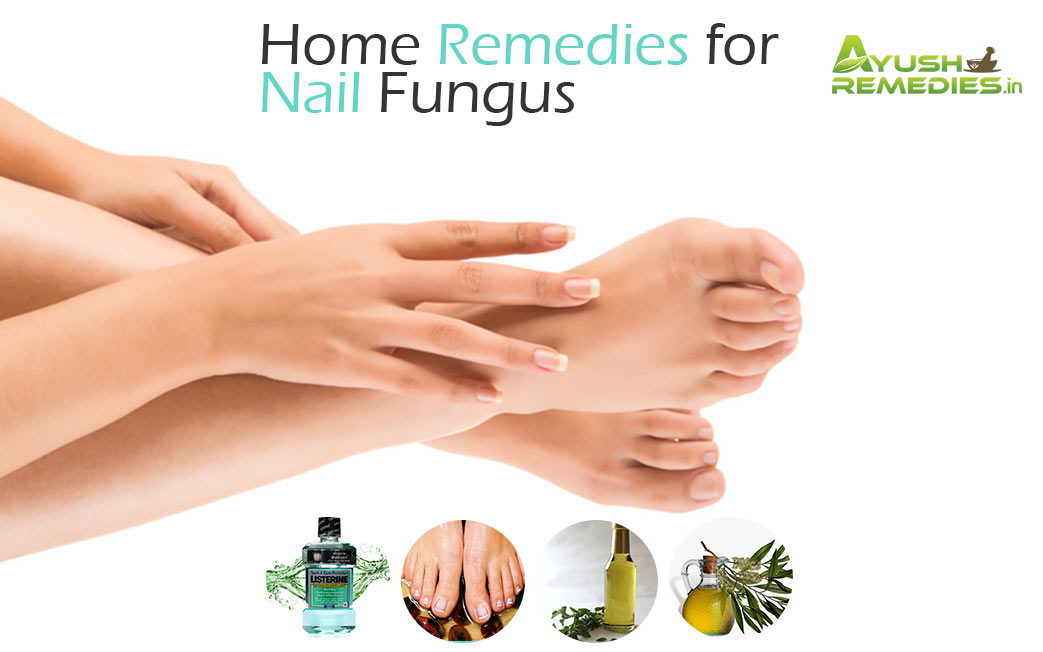 Home Remedies for Nail Fungus