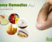 Home Remedies for Psoriasis