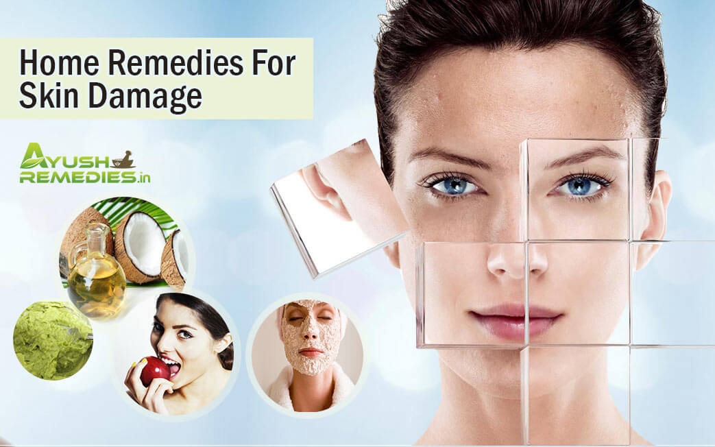 Home Remedies for Skin Damage