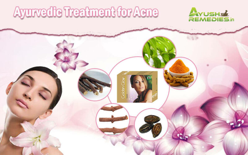 Ayurvedic Treatment for Acne, Pimples Herbal Remedies