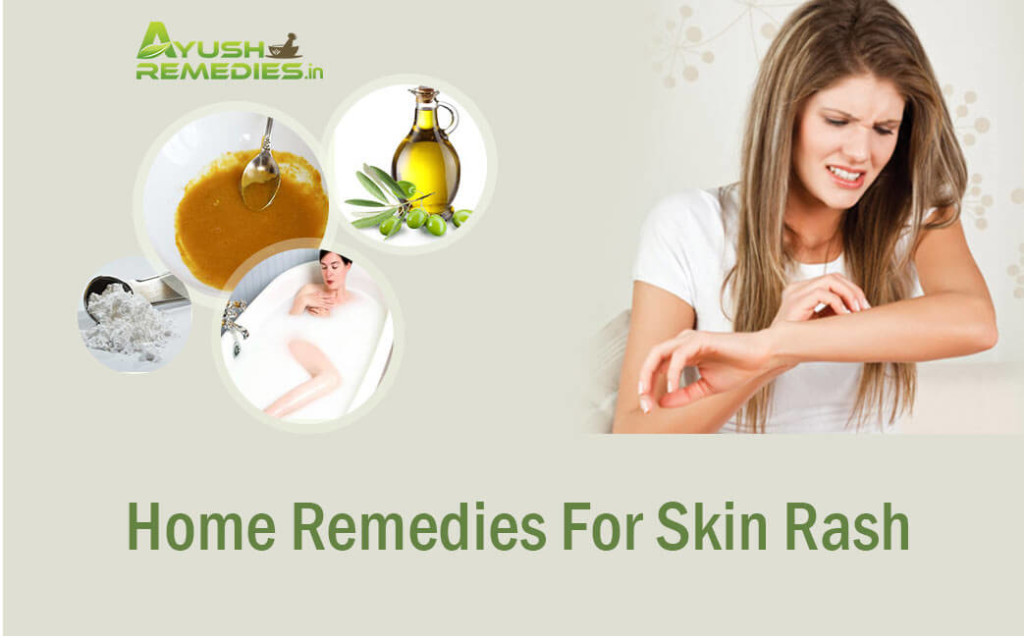 Home Remedies for Skin Rashes