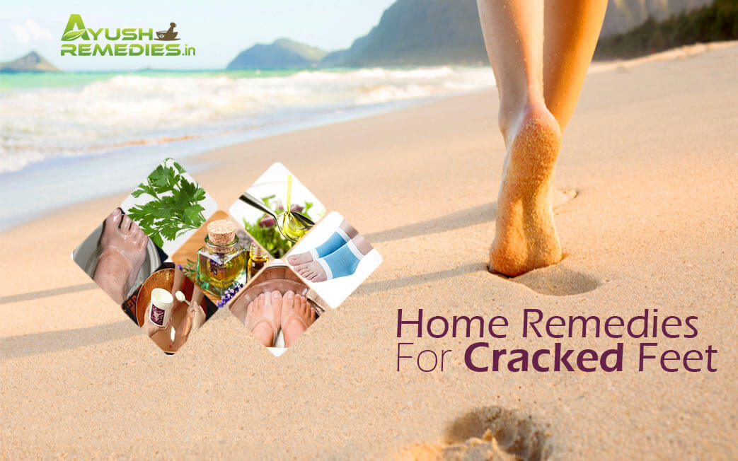 Get Beautiful Feet: 6 Home Remedies for Cracked Heels