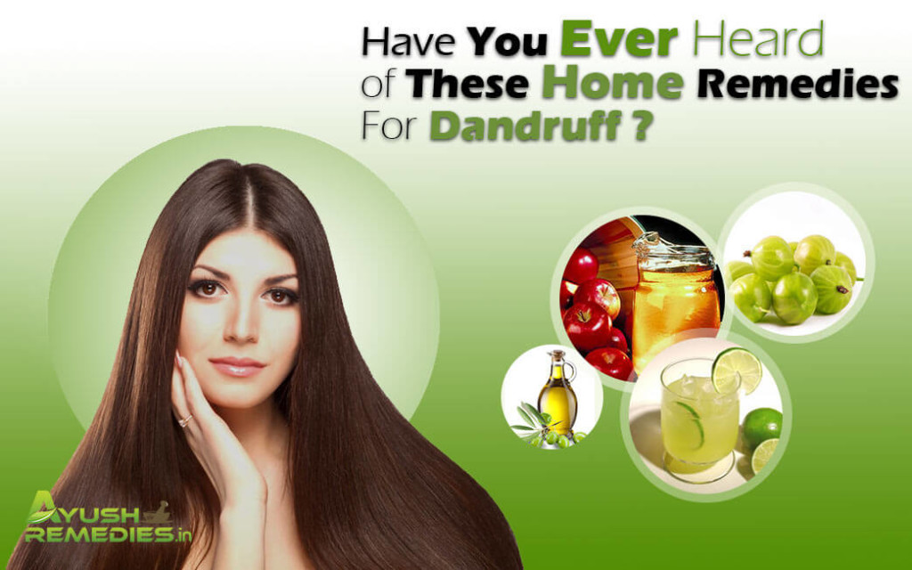 Home Remedies for Dandruff