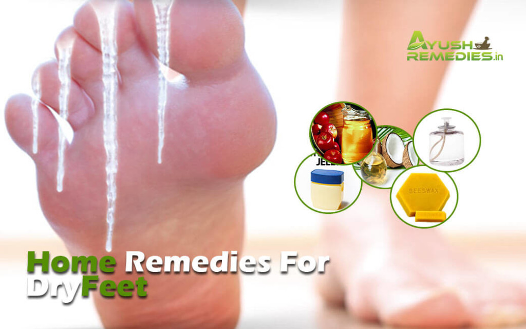 Home Remedies For Dry Feet