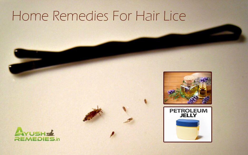 Home Remedies For Hair Lice