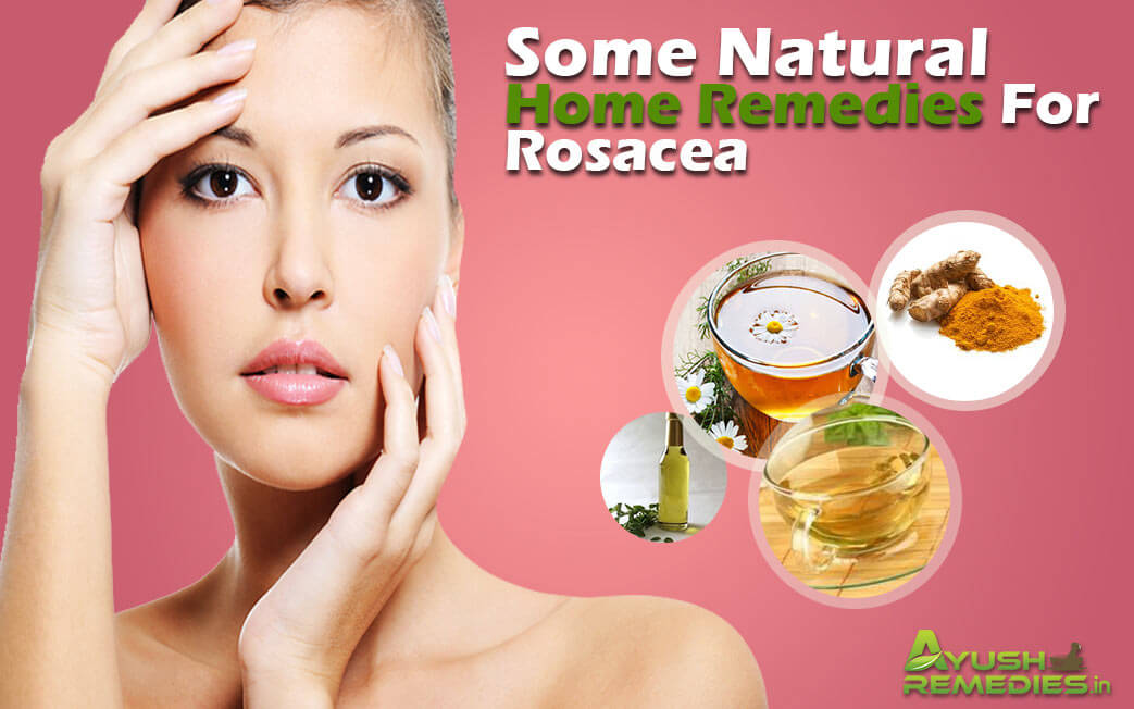 Home Remedies For Rosacea