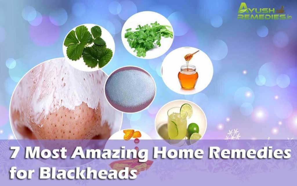 Home Remedies for Blackheads