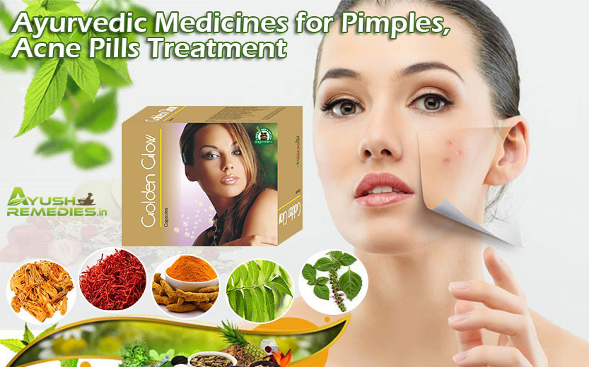 Ayurvedic Medicines for Pimples