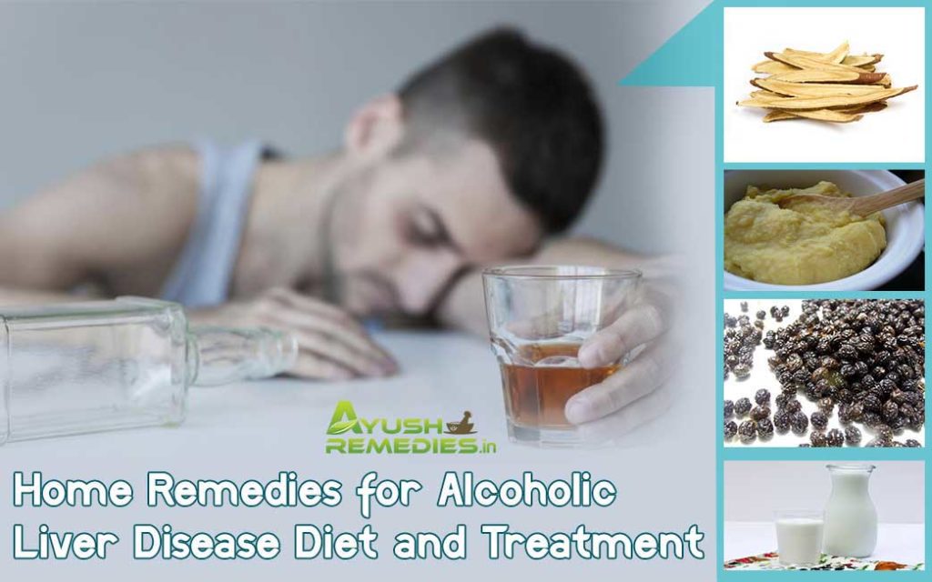 Home Remedies For Alcoholic Liver Disease