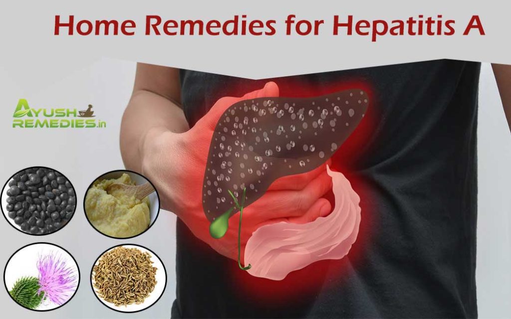 Home Remedies For Hepatitis A