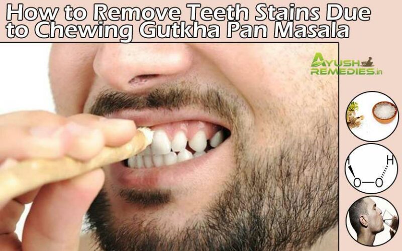 How to Remove Teeth Stains Due to Chewing Gutkha Pan Masala?