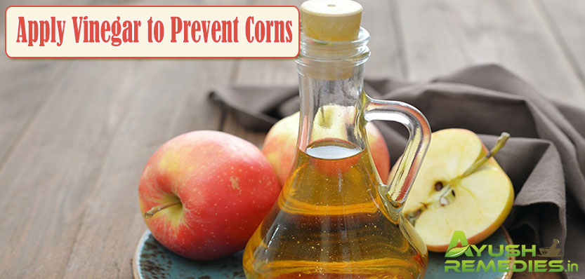 Apply Vinegar to Prevent Corns