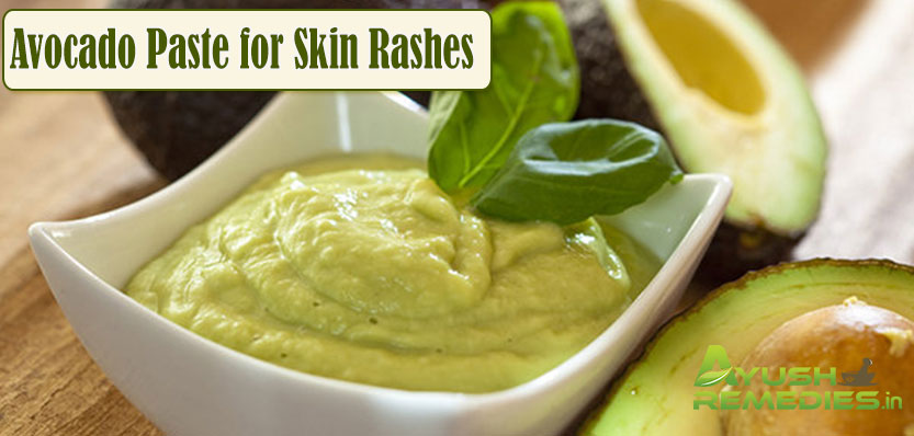 Avocado Paste for Skin Rashes