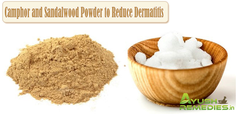 Camphor and Sandalwood Powder to Reduce Dermatitis