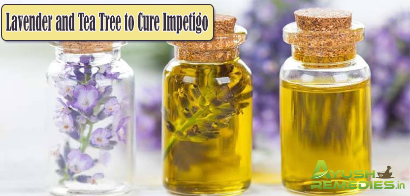 Lavender and Tea Tree to Cure Impetigo