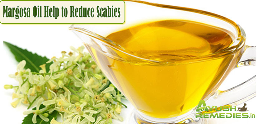 Margosa Oil Help to Reduce Scabies