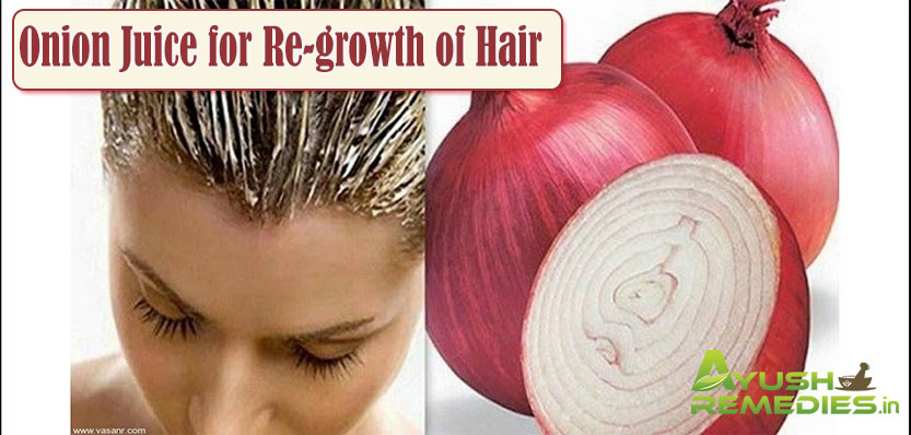 Onion Juice to Re-growth of Hair