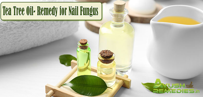 Tea Tree Oil Remedy for Nail Fungus