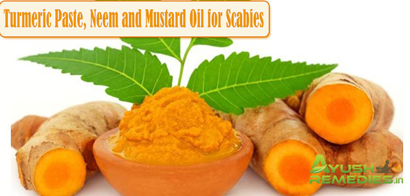 Turmeric, Neem and Mustard Oil for Scabies