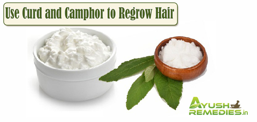 Use Curd and Camphor to Regrow Hair on Bald Spot