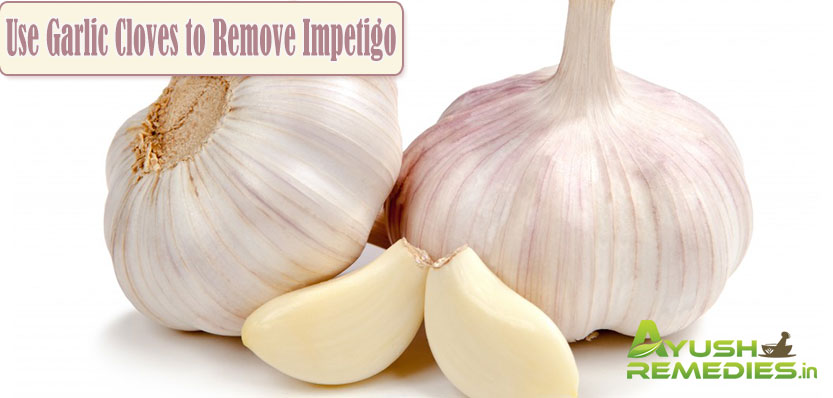 Use Garlic Cloves to Remove Impetigo