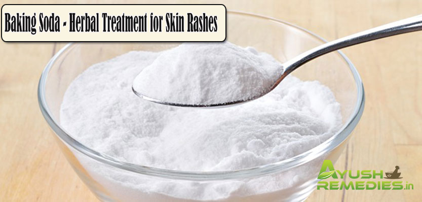 Baking Soda Herbal Treatment for Skin Rashes