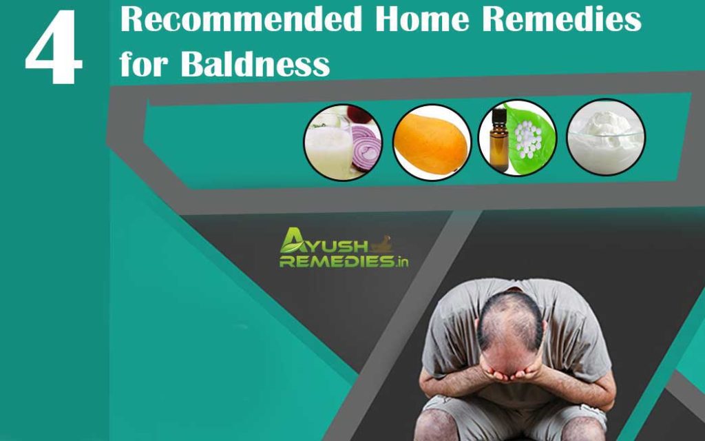 Home Remedies for Baldness