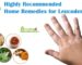 Home Remedies for Leucoderma