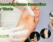 Home Remedies for Warts