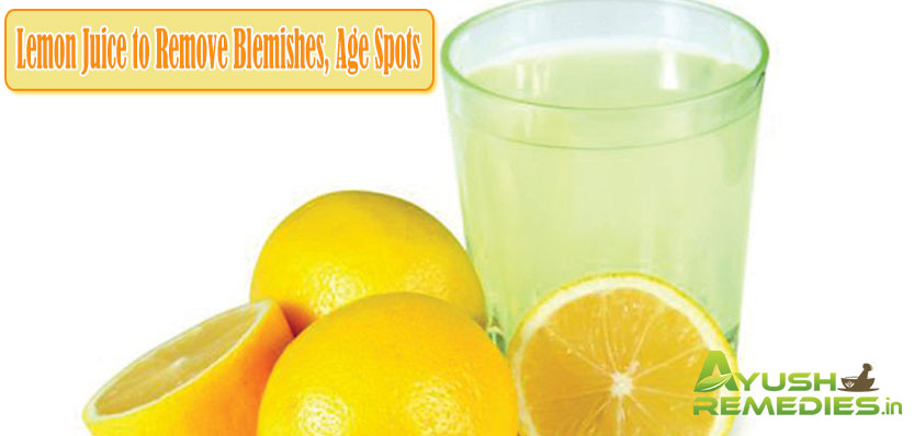 Lemon Juice to Remove Blemishes, Age Spots