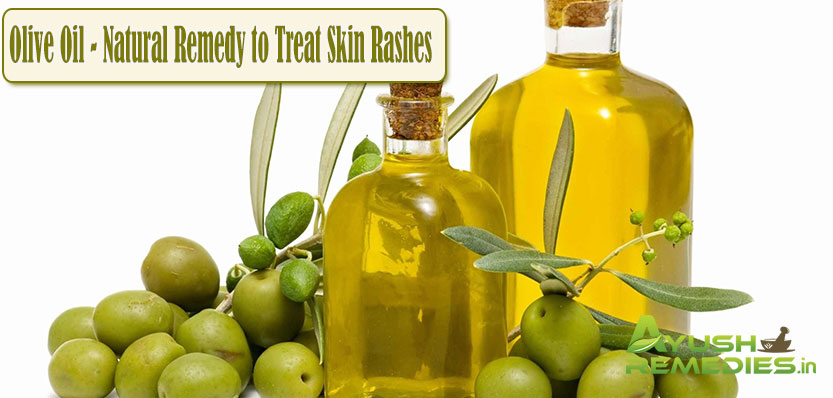 Olive Oil Natural Remedy to Treat Skin Rashes