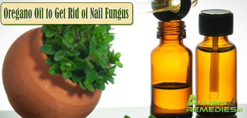 Oregano Oil to Get Rid of Nail Fungus