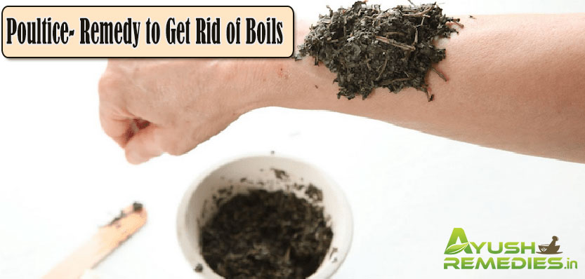 poultic Remedy to Get Rid of Boils