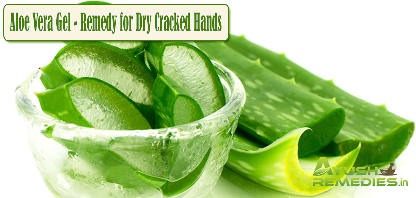 Aloe Vera Gel Remedy for Dry Cracked Hands