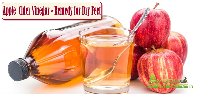 Apple Cider Vinegar Remedy for Dry Feet