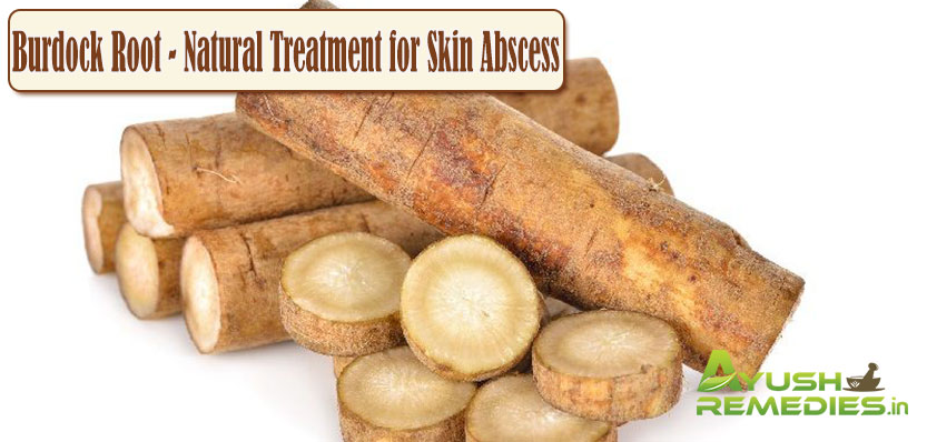 Burdock Root Natural Treatment for Skin Abscess