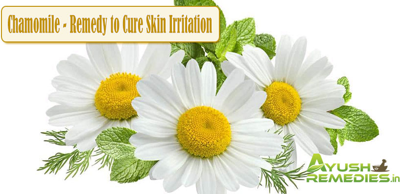 Chamomile Remedy to Cure Skin Irritation