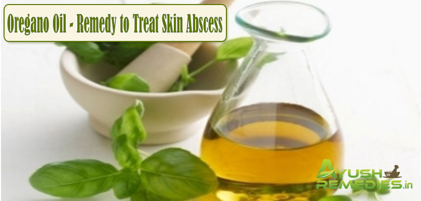 Oregano Oil Remedy to Treat Skin Abscess