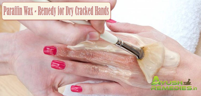 Paraffin Wax Remedy for Dry Cracked Hands