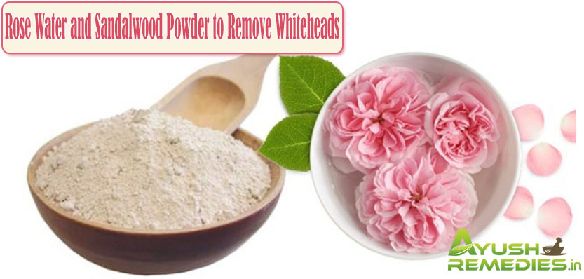 Rose Water and Sandalwood Powder to Remove Whiteheads