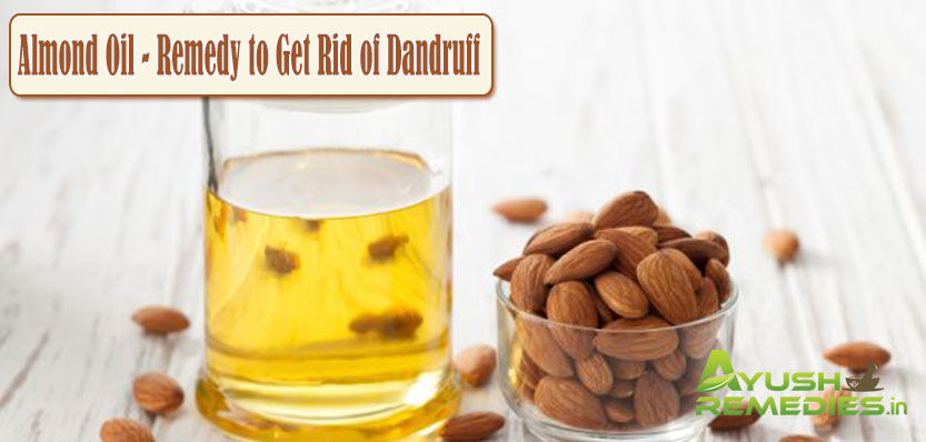 Almond Oil Remedy to Get Rid of Dandruff