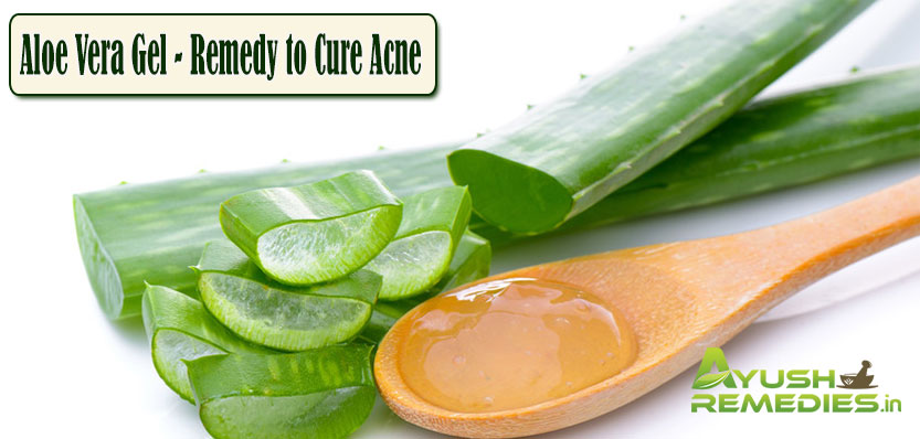 Aloe Vera Gel Remedy to Cure Acne