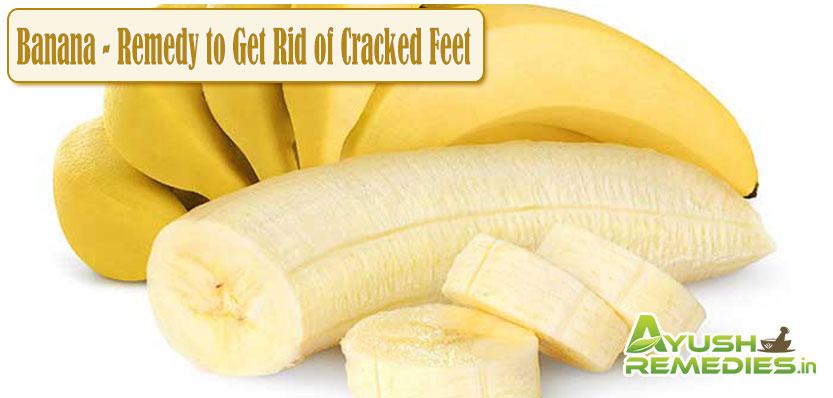 Banana Remedy to Get Rid of Cracked Feet