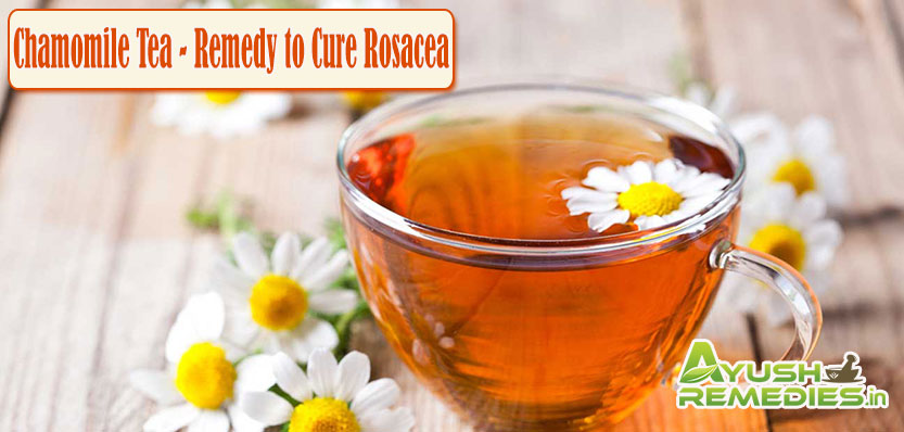 Chamomile Tea Remedy to Cure Rosacea