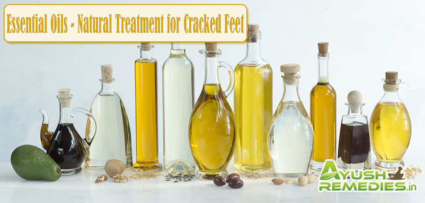 Essential Oils Natural Treatment for Cracked Feet