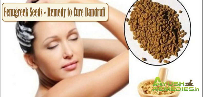 Fenugreek Seeds Remedy to Cure Dandruff