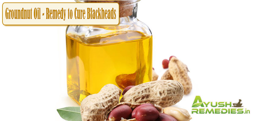 Groundnut Oil Remedy to Cure Blackheads