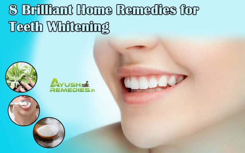 8 Home Remedies for Teeth Whitening, Whiten Your Teeth Naturally