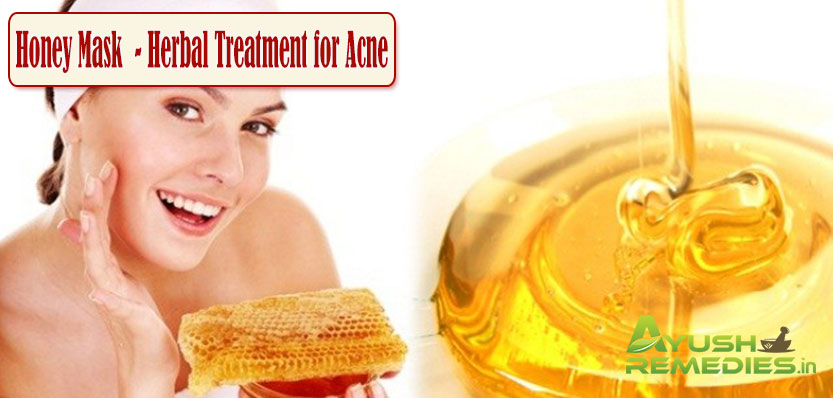 Honey Mask Herbal Treatment for Acne