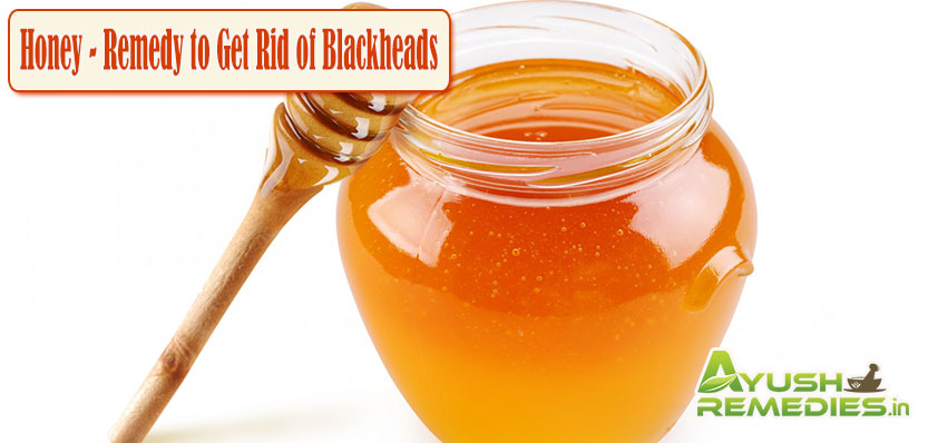 Honey Remedy to Get Rid of Blackheads